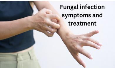 Fungal infection symptoms and treatment