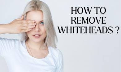 How to remove whiteheads