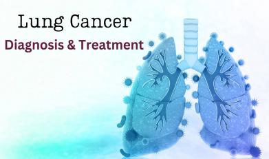 Lung Cancer Diagnosis & Treatment