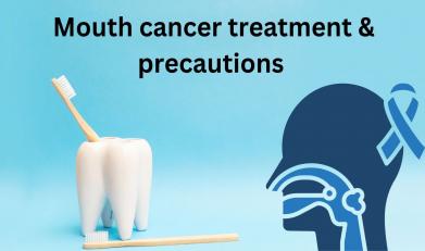 Mouth cancer treatment & precautions