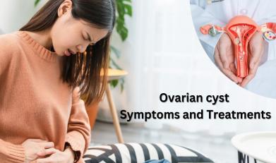 Ovarian cyst Symptoms and Treatments