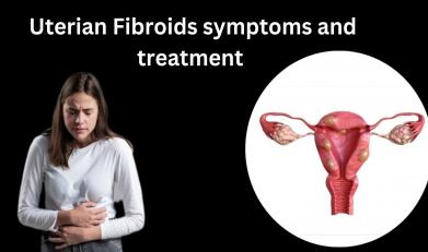 Uterine fibroids symptoms and  treatment