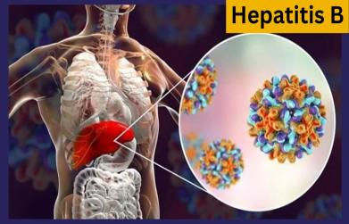 How to cure hepatitis B