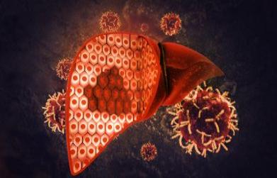 How to cure fatty liver naturally