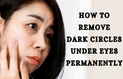 How to remove dark circles under eyes permanently