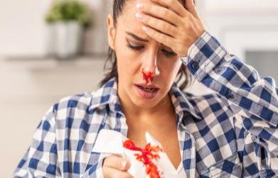 How to stop nose bleeding