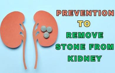 Prevention to remove stone from kidney