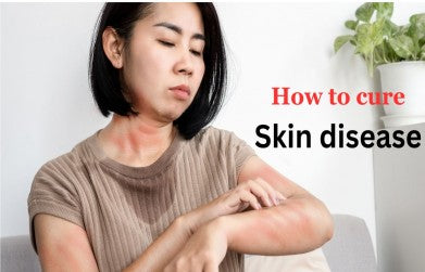 Skin diseases