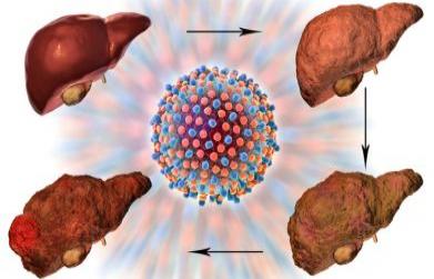 Some Signs of Damage Liver