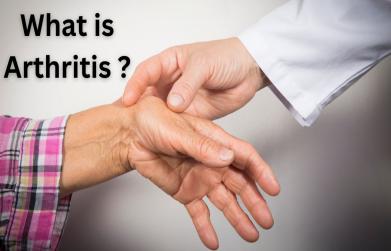 What is Arthritis ?