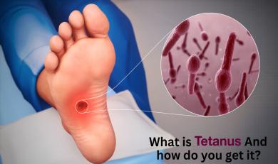 What is Tetanus and How do you get it ?